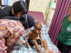Kapolresta : Sepasang Pasutri di Polisikan Akibat Aniaya Anak Umur 5 Tahun di Organda Padang Bulan Korban Pemukulan dari Orang Tuanya - Doc. Polres Kota Jayapua